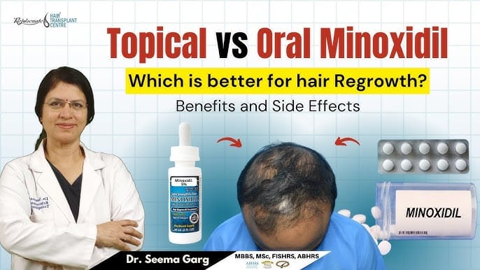 Who should choose oral versus topical minoxidil?