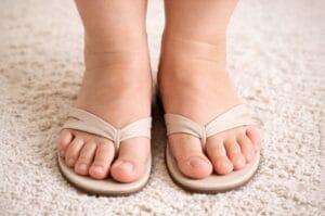 swollen ankles pregnancy